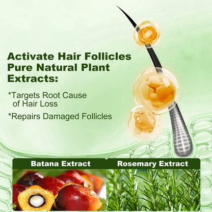 Tgideas Batana Oil & Rosemary Shampoo for Hair Growth, Sulfate-Free Formula to Reduce Hair Loss, Nourish Scalp & Add Volume, for Men & Women (Pack of 1)