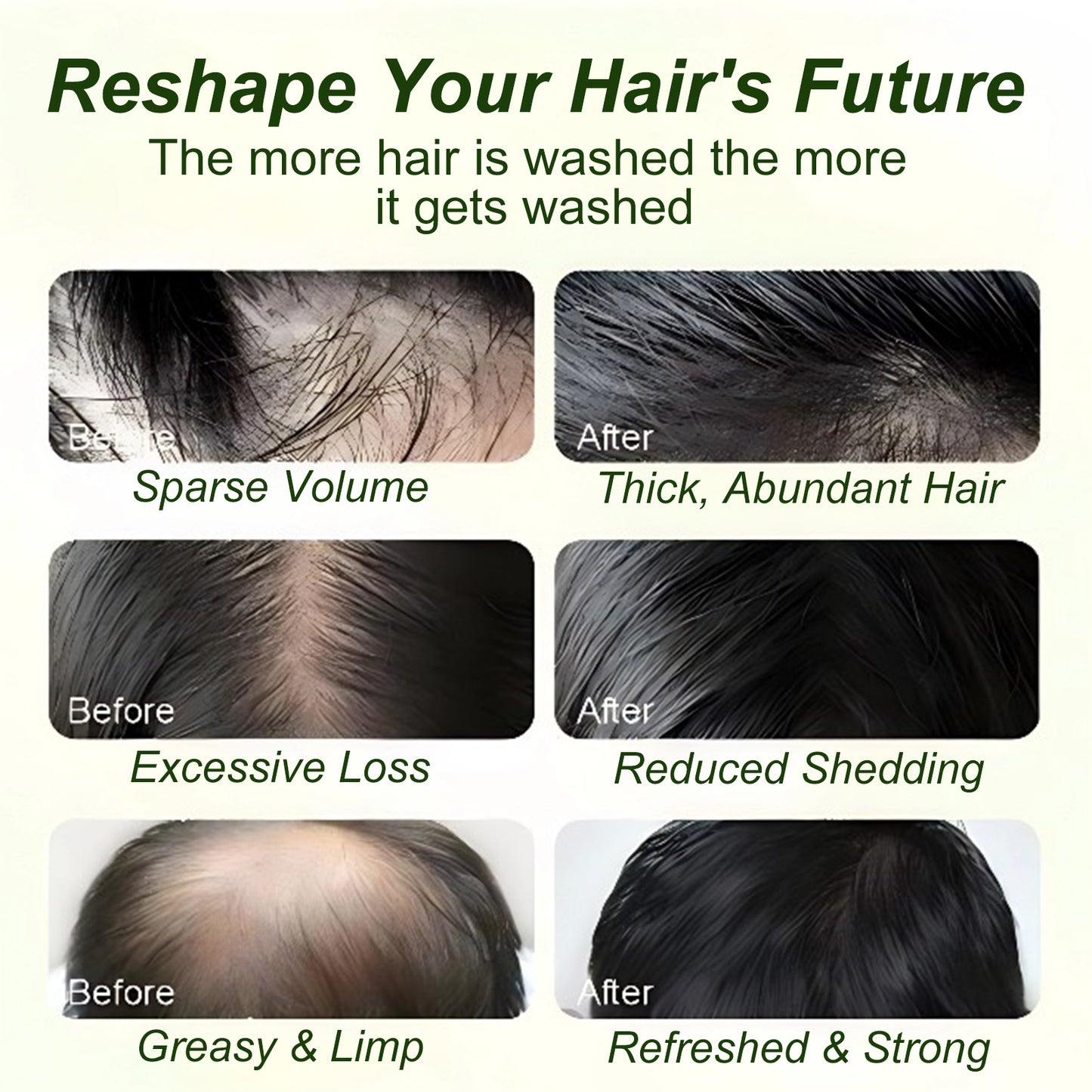 Tgideas Batana Oil & Rosemary Shampoo for Hair Growth, Sulfate-Free Formula to Reduce Hair Loss, Nourish Scalp & Add Volume, for Men & Women (Pack of 1)