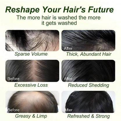 Tgideas Batana Oil & Rosemary Shampoo for Hair Growth, Sulfate-Free Formula to Reduce Hair Loss, Nourish Scalp & Add Volume, for Men & Women (Pack of 1)